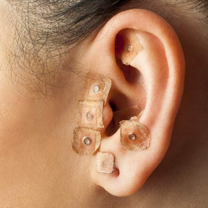 Spécialiste en auriculothérapie Pont-Audemer
